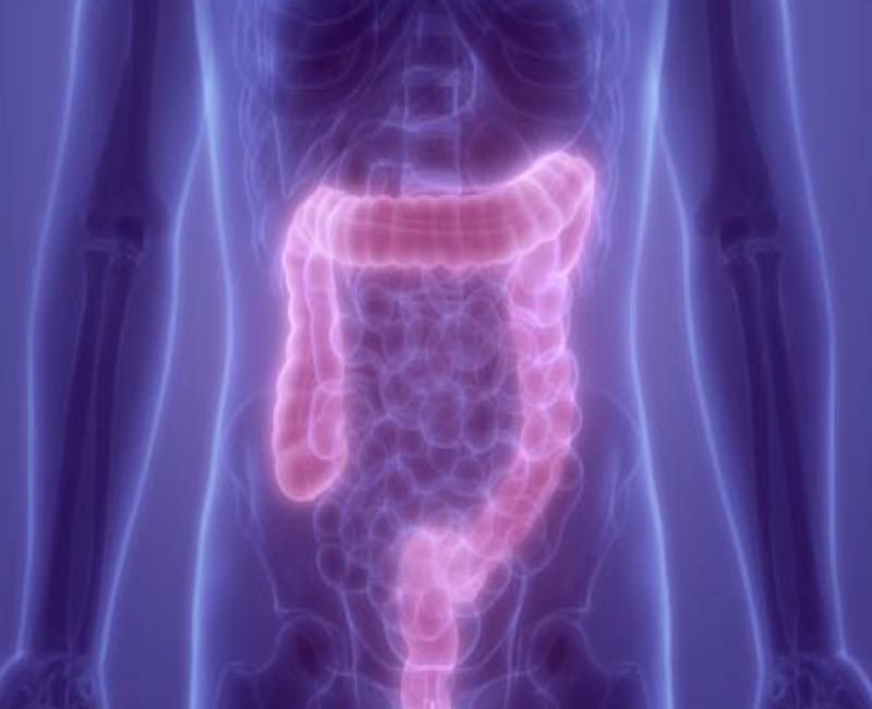 X Ray of a person's Colon and GI Track